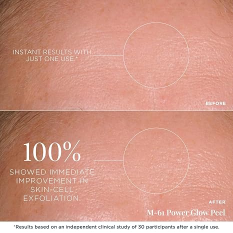 m-61 PowerGlow Peel, 30 Treatments | Exfoliating Facial Peel, Glycolic & Salicylic Acid, 1 Minute, 1 Step