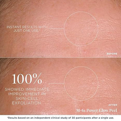 m-61 PowerGlow Peel, 30 Treatments | Exfoliating Facial Peel, Glycolic & Salicylic Acid, 1 Minute, 1 Step